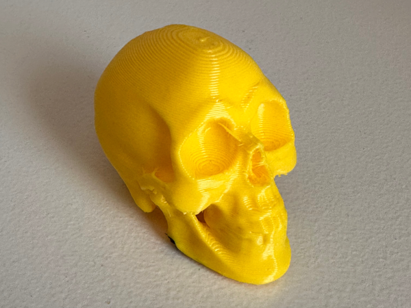 Skull